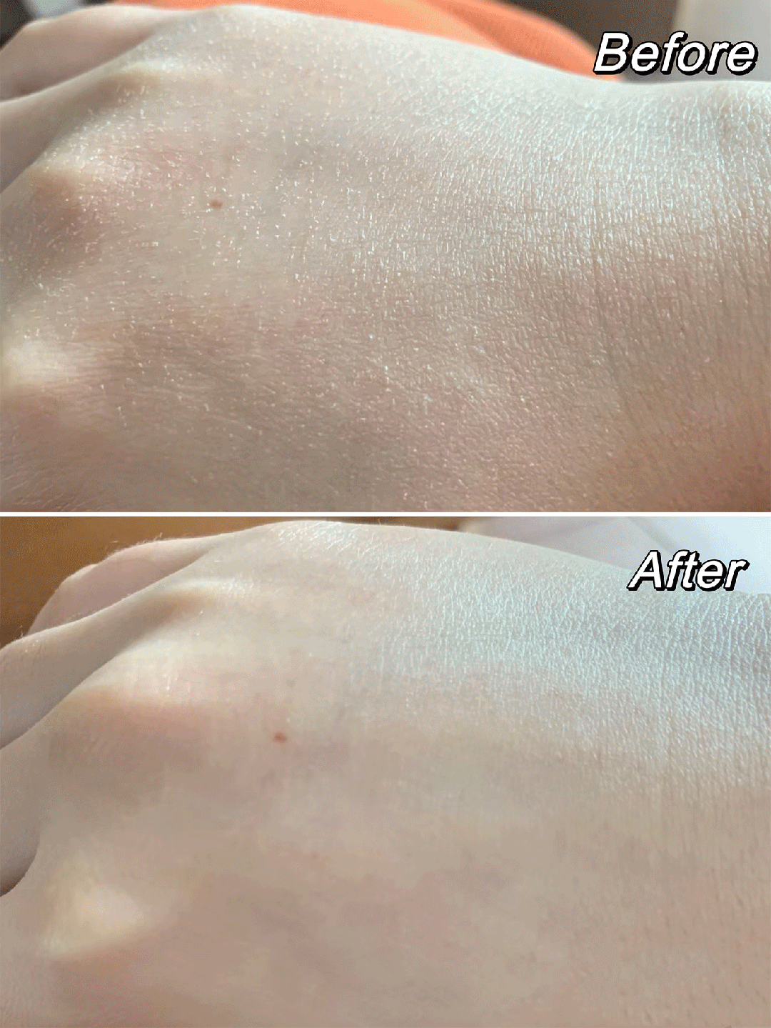 不朽情缘官网登录手足干裂的人试试这个外抹的方子一试就灵(图20)